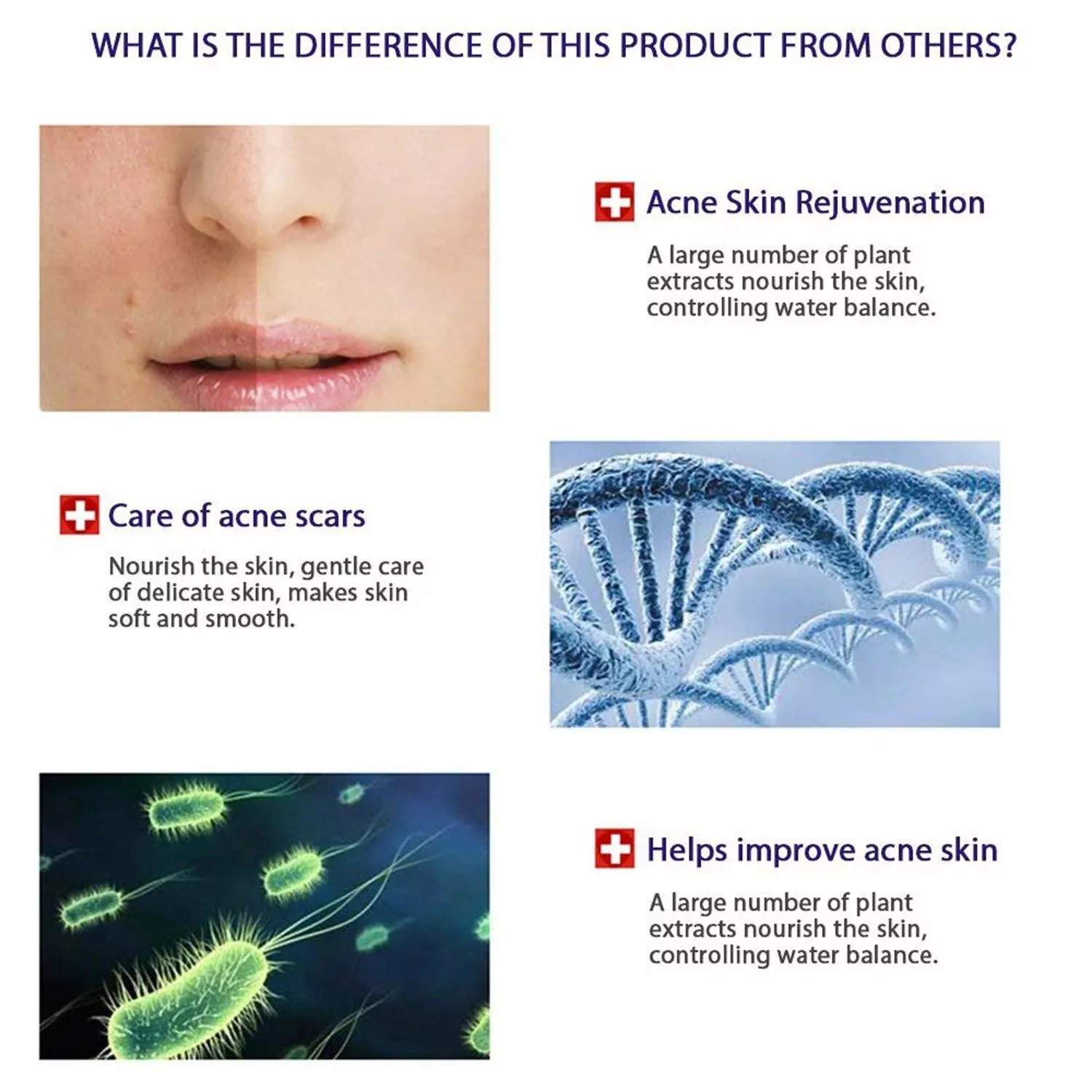 BIOAQUA Skin Care Acne Face Removal Cleanser Cream Spots Scar Blemish Mark 100g