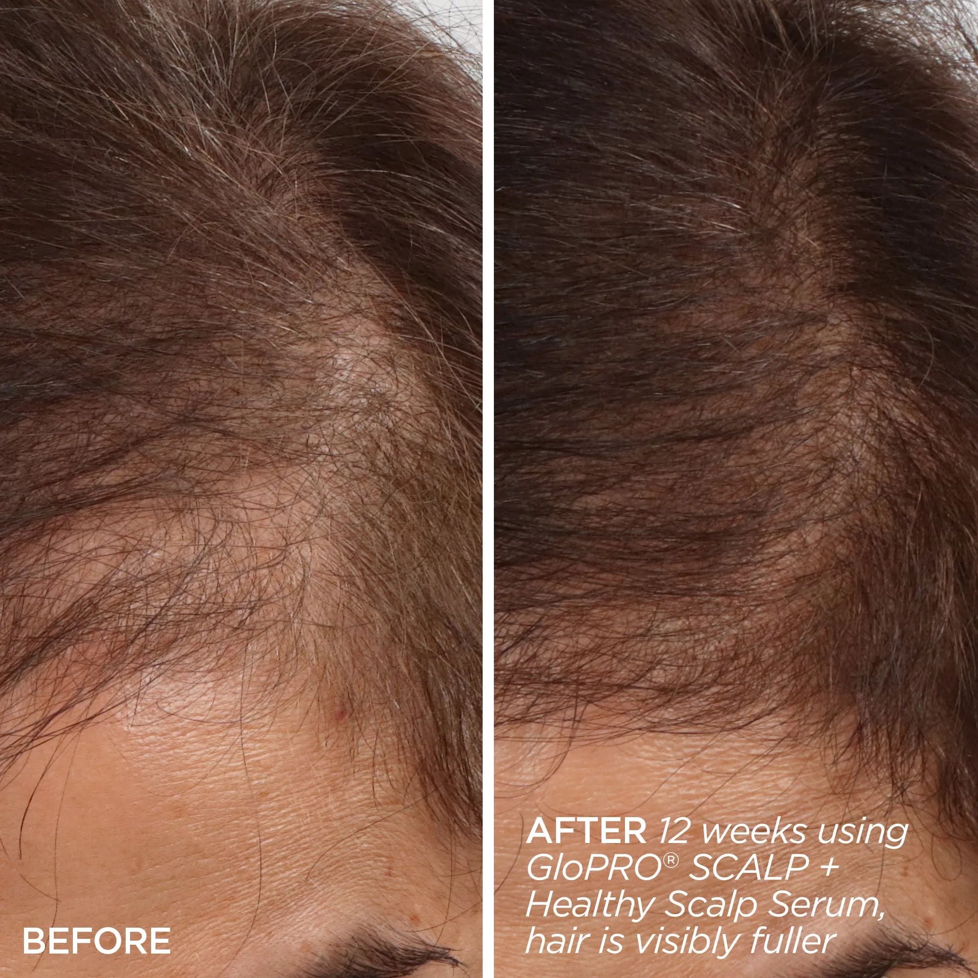 Rejuvenating Scalp   Fuller Hair Therapy Set Blush Leopard  *FINAL SALE*