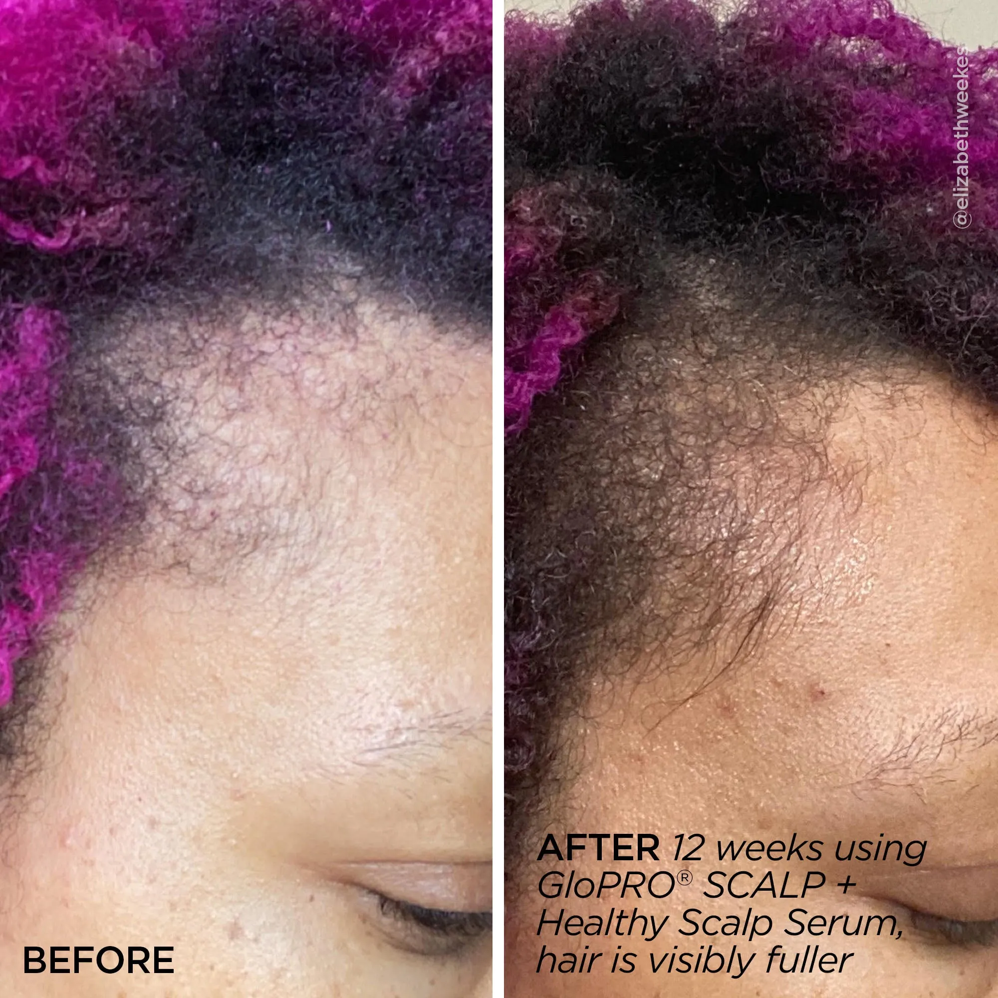 Rejuvenating Scalp   Fuller Hair Therapy Set Blush Leopard  *FINAL SALE*